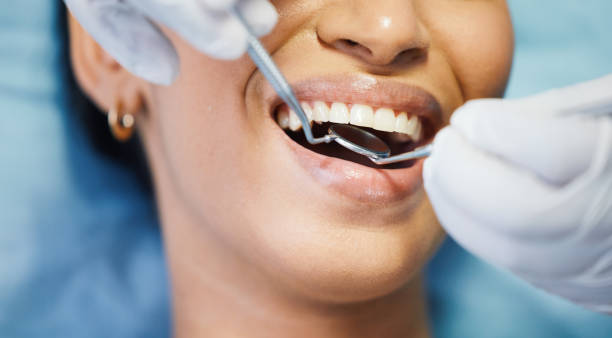 Best Emergency Root Canal Treatment in Shady Side, MD