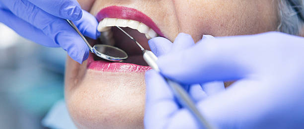 Best Emergency Wisdom Teeth Removal in Shady Side, MD